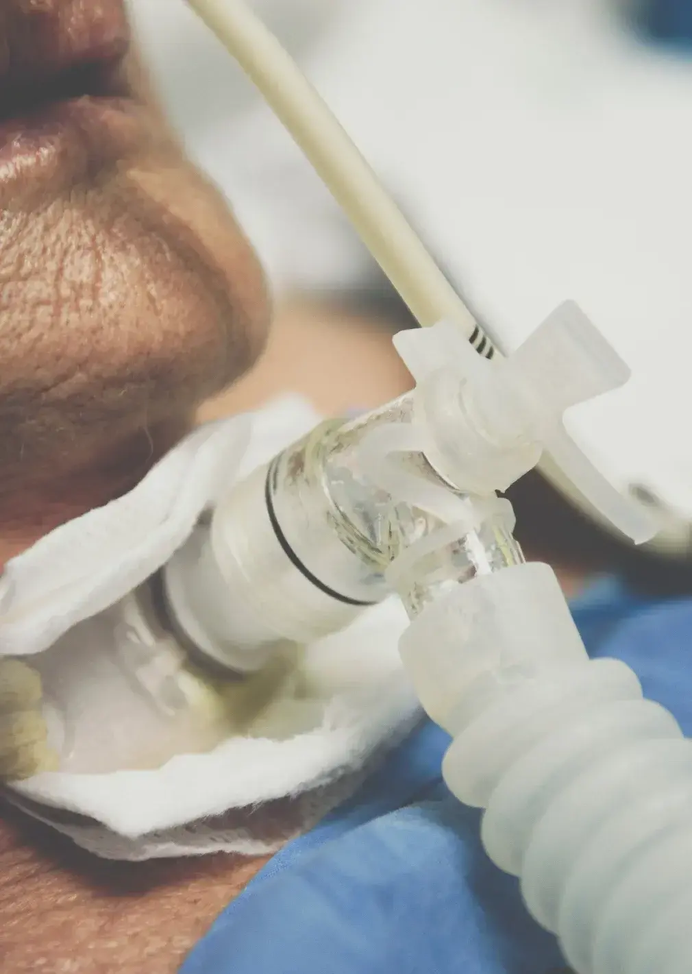 Tracheostomy Care