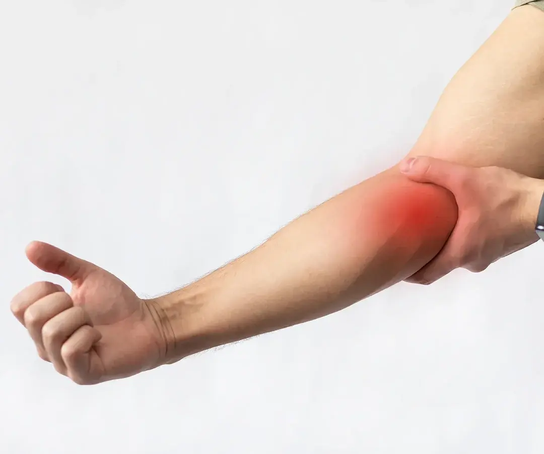 Sciatica and nerve compression 